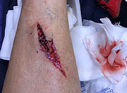Corte en la tibia